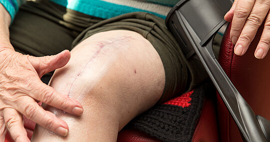 Frau fasst mit Hand über ihre Narbe am Knie